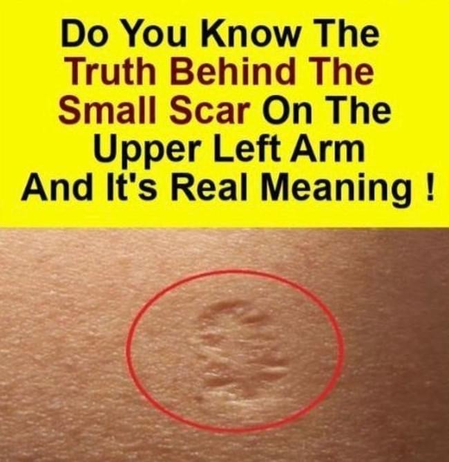 The Truth Behind The Small Scar On Upper Left Arm. Here’s What It Really Means